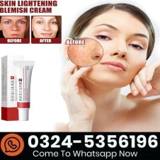 Zooson Freckle Cream In Pakistan